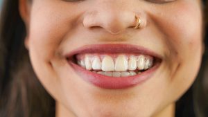 invisalign 300x169 - The Different Types of Braces, Explained