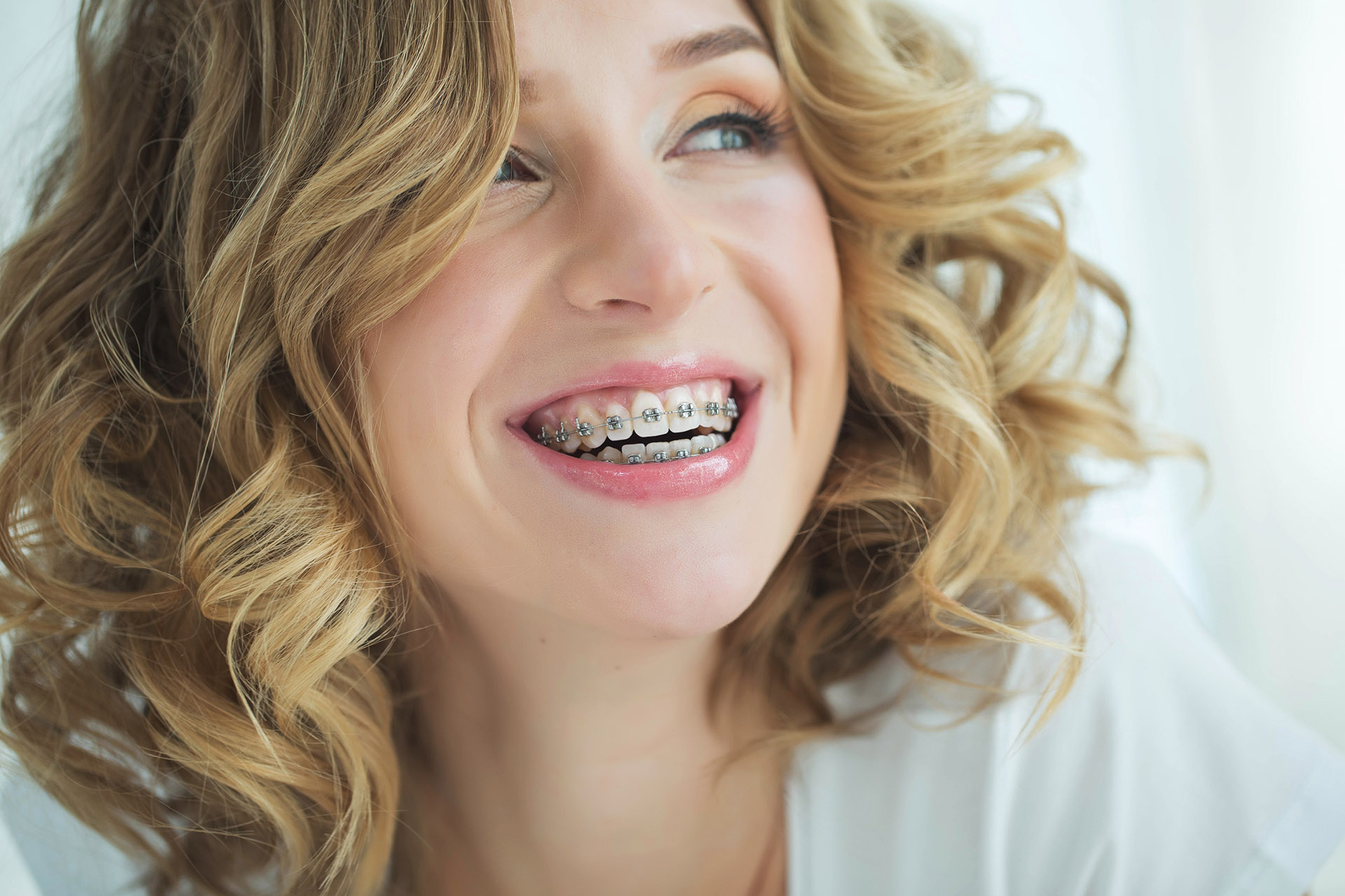 adult braces 2 - Braces for Adults: It's Never Too Late to Get the Smile You Want