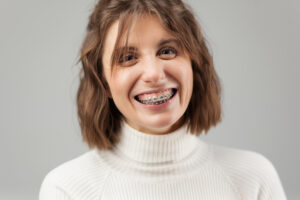 adult braces 3 300x200 - Braces for Adults: It's Never Too Late to Get the Smile You Want