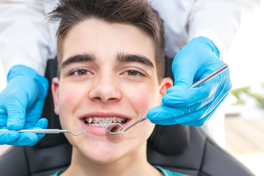 boy braces 275154455 1024x683 - Debunking Orthodontic Myths: The Truth Behind the Braces
