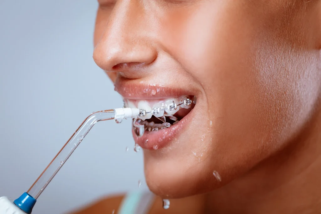 water pik 1024x683 - Easy Tips for Cleaning Between Your Teeth When You Have Braces